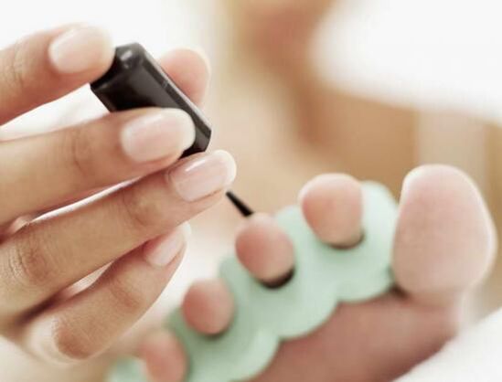 Θεραπεία νυχιών με βερνίκι νυχιών για μυκητιασική λοίμωξη